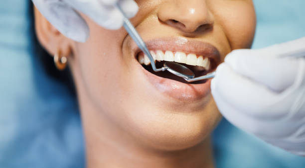 Best Emergency Dental Care for Broken or Chipped Teeth in Moose Lake, MN